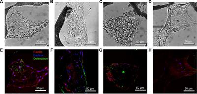 Optimizing Barium Titanate Nanocomposite Bone Scaffolds for Biomineralization in Dynamic Compression Bioreactors Using Time-Lapsed Microstructural Imaging and Smart Thresholding